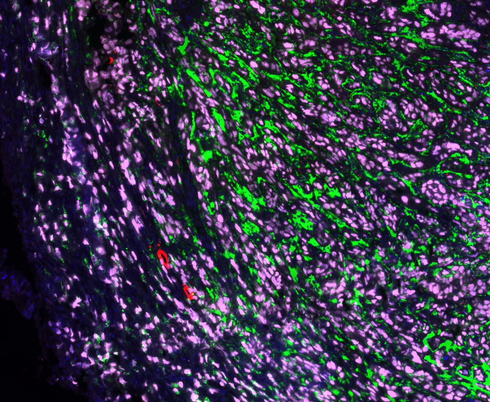 荧光单标放大试剂盒(cy5)