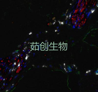 七色多重免疫荧光试剂盒（兔鼠通用二抗）