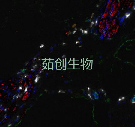 七色多重免疫荧光试剂盒（兔鼠通用二抗）