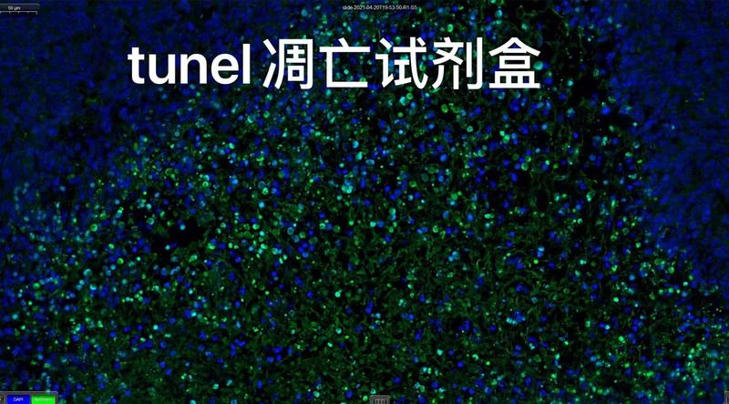 绿色荧光tunel试剂盒