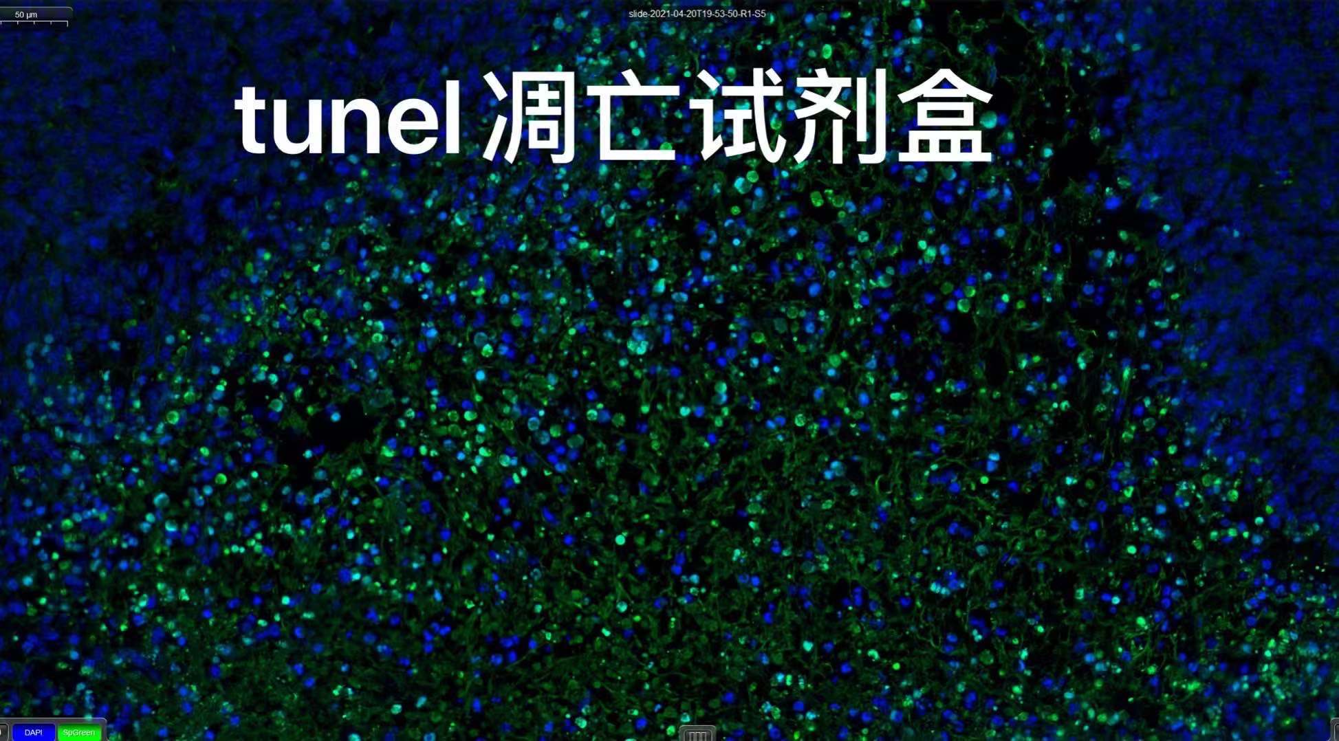 绿色荧光tunel试剂盒