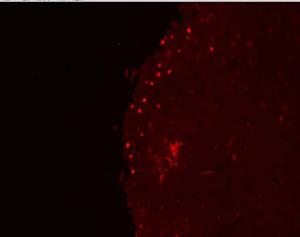 红色荧光tunel试剂盒