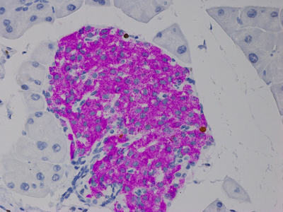 红色免疫组化显色试剂盒