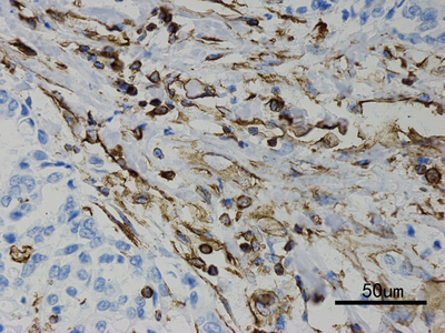 免疫组化试剂盒（抗兔二抗）