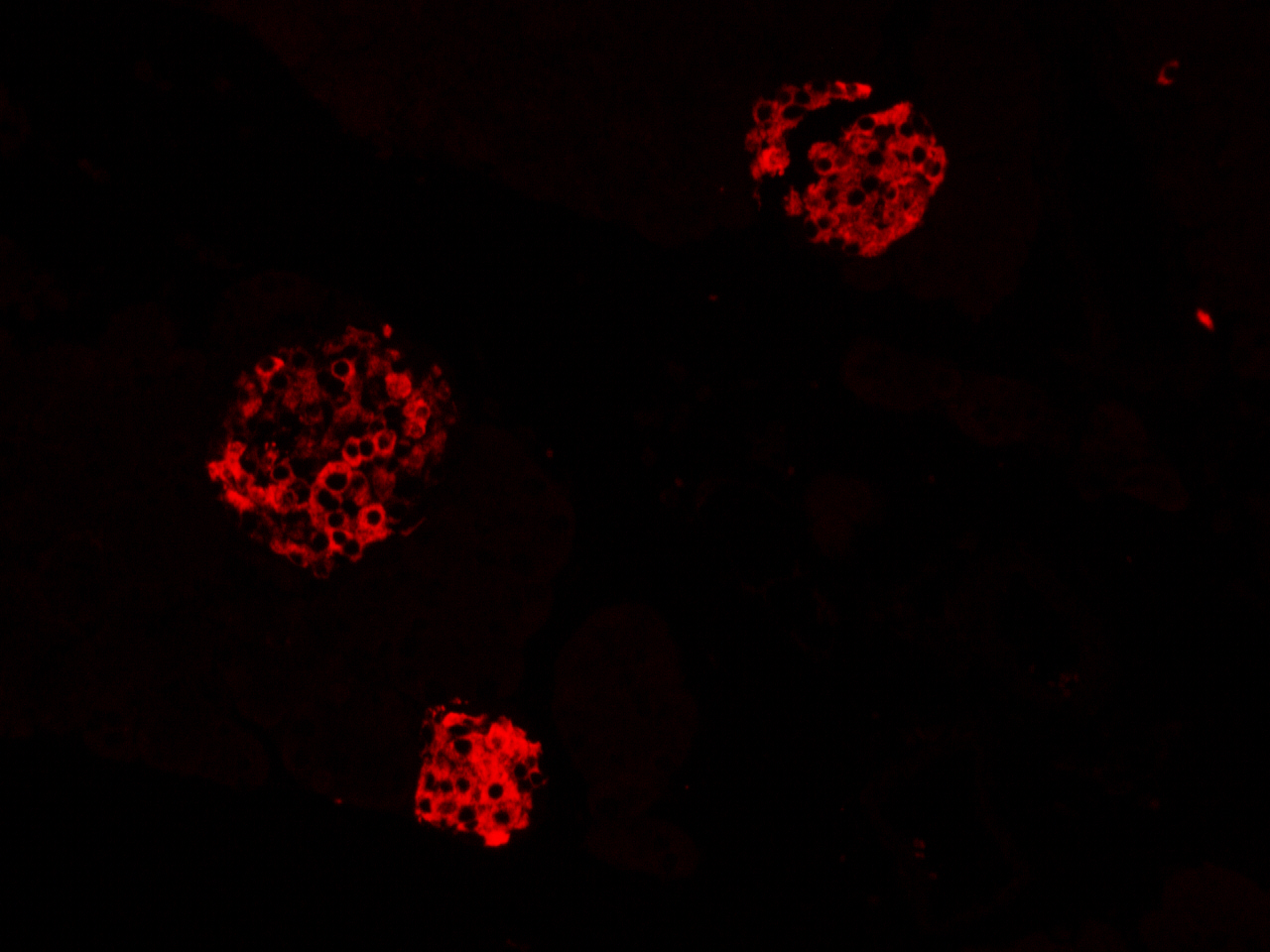 荧光单标放大试剂盒(594)