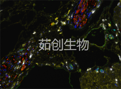 七色多重免疫荧光试剂盒（抗兔二抗）