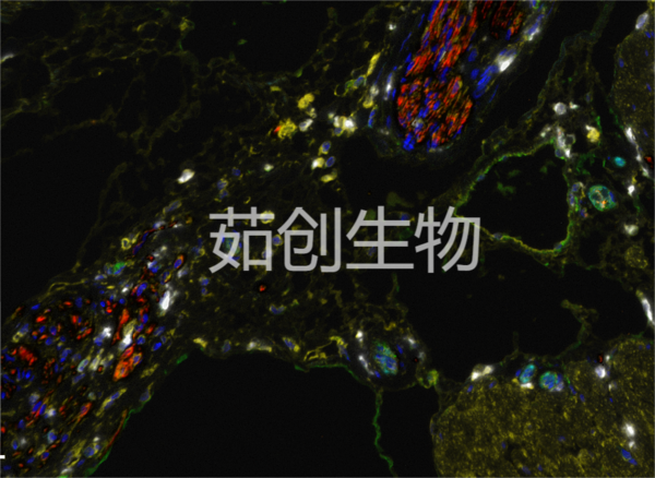 七色多重免疫荧光试剂盒（抗兔二抗）