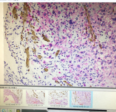 组化双染试剂盒